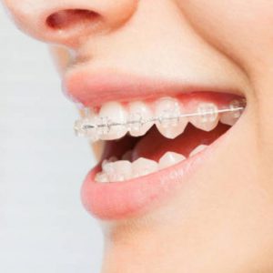 Orthodontics Boondall