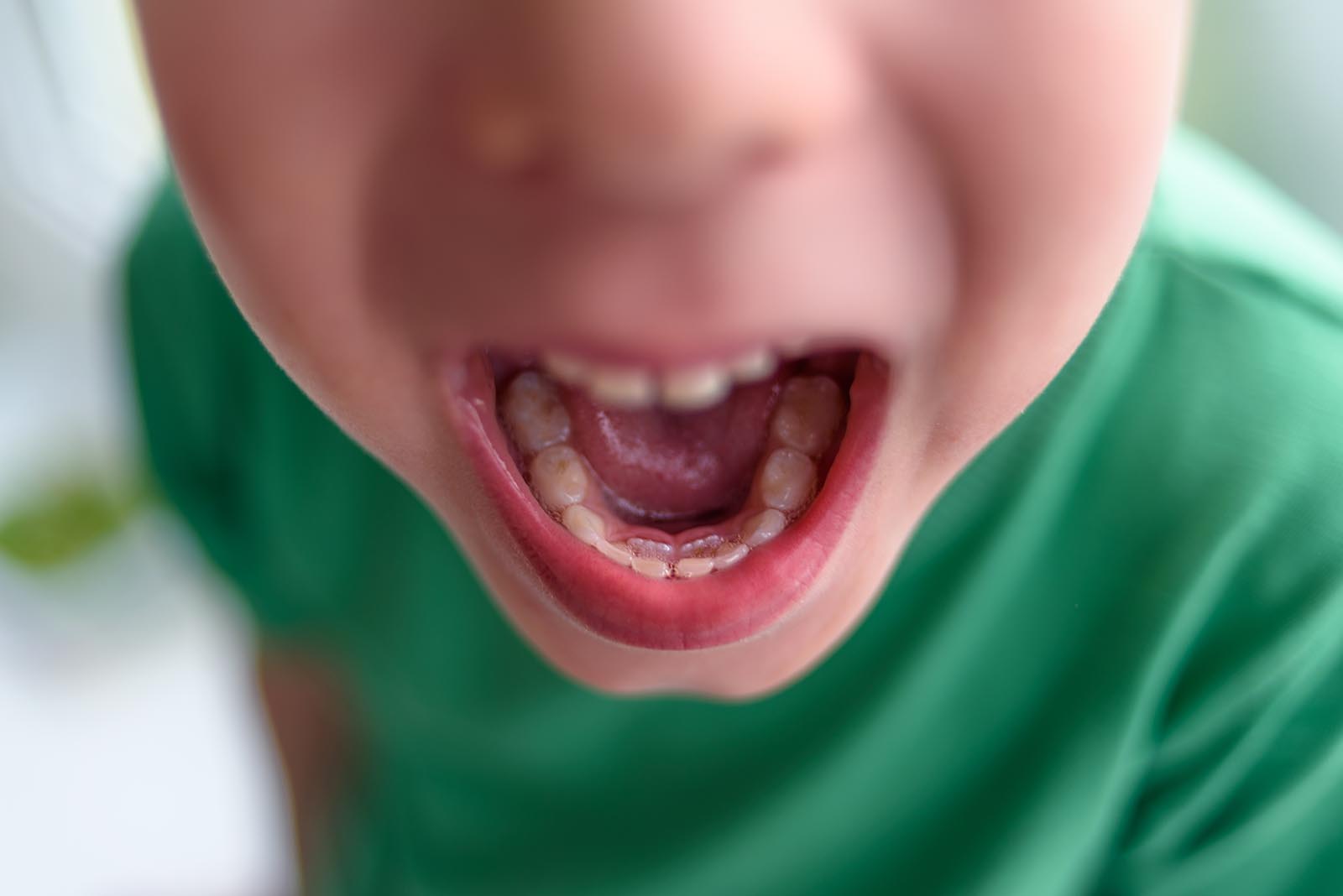 child shark teeth